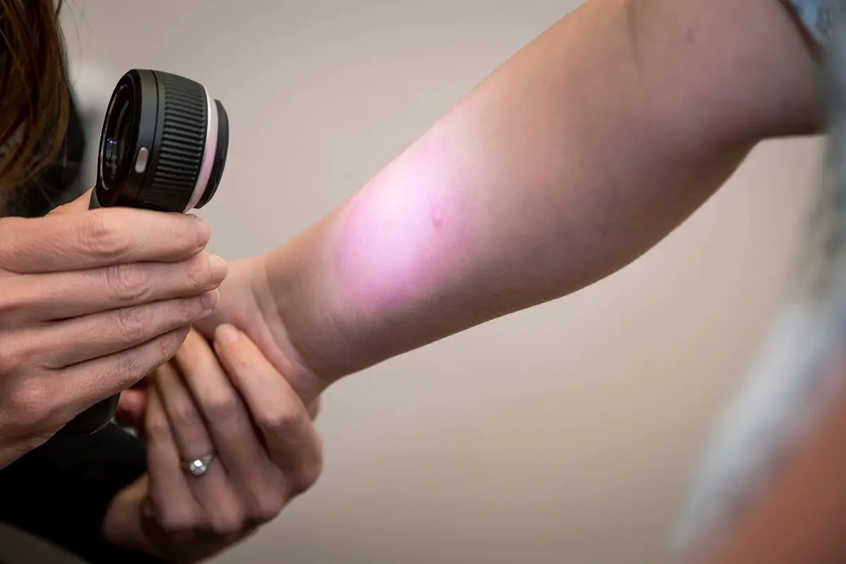 Doctor using a medical device to look closely at a skin rash